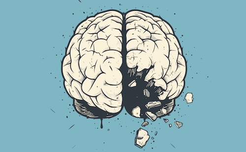 brainrot